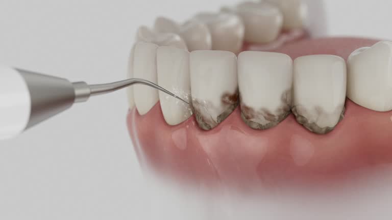 Reliable Dental contractor in Burlington, OH by Dentist Open Now